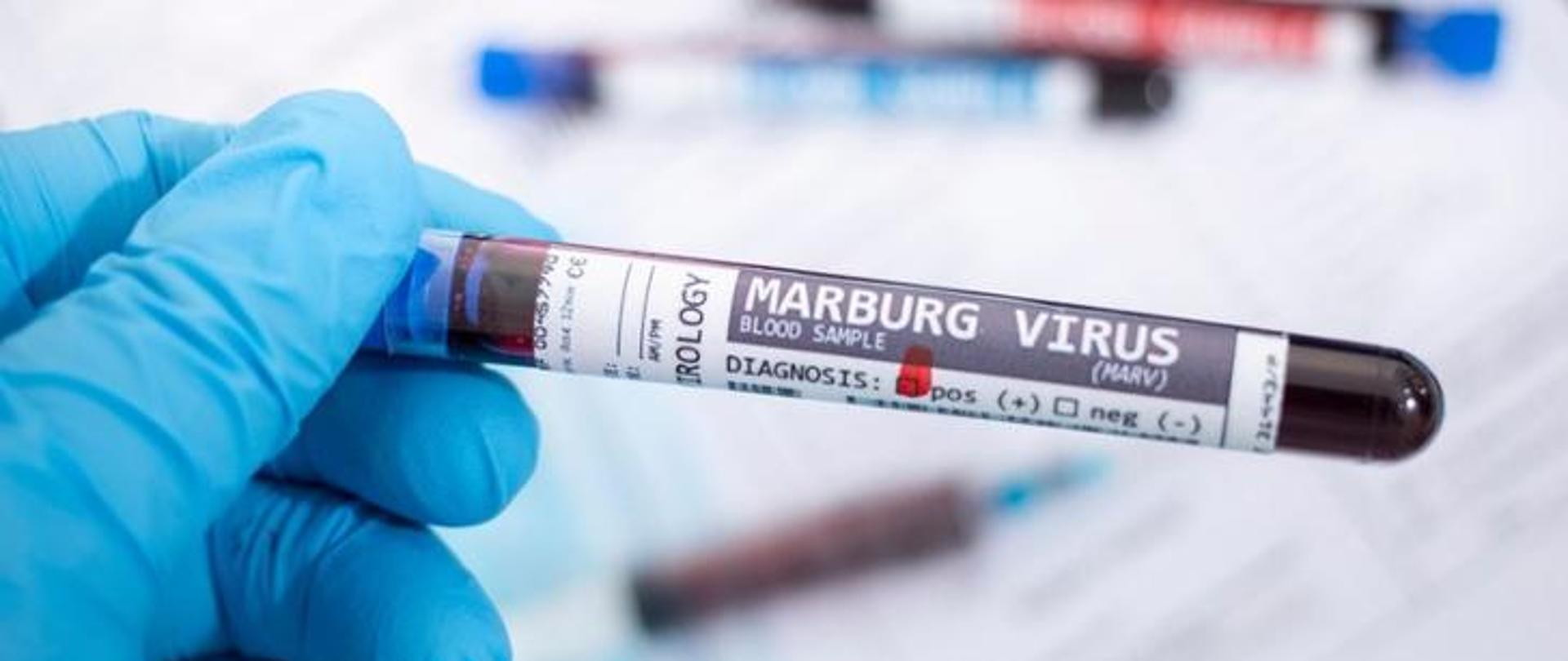 Próbówka z napisem Marburg_Virus