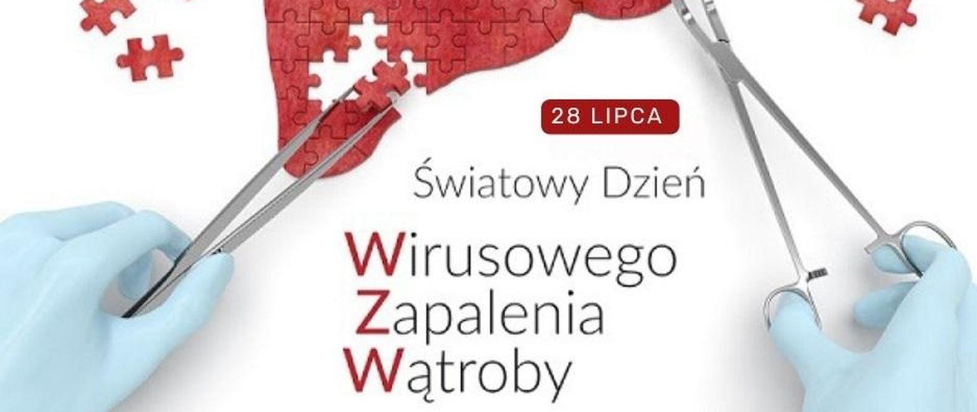 „Światowy Dzień Wirusowego Zapalenia Wątroby (WZW)”