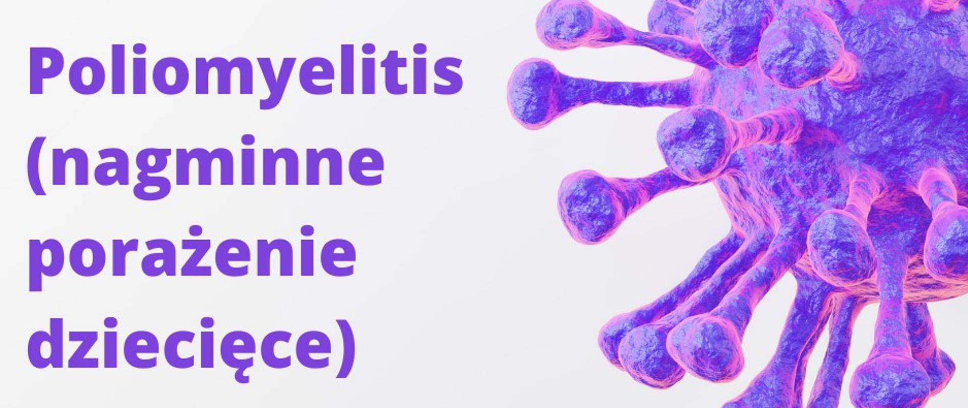 Poliomyelitis