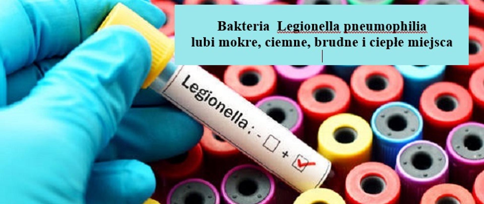 Blood sample positive with legionella