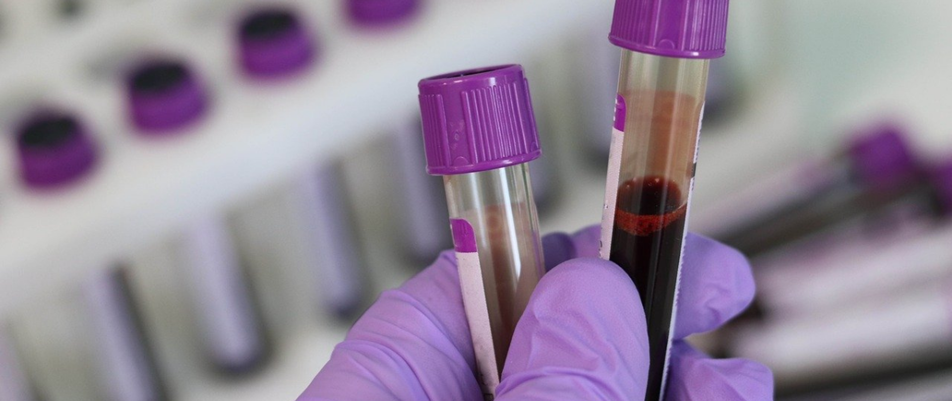 Krew trzymana w laboratoryjnych probówkach