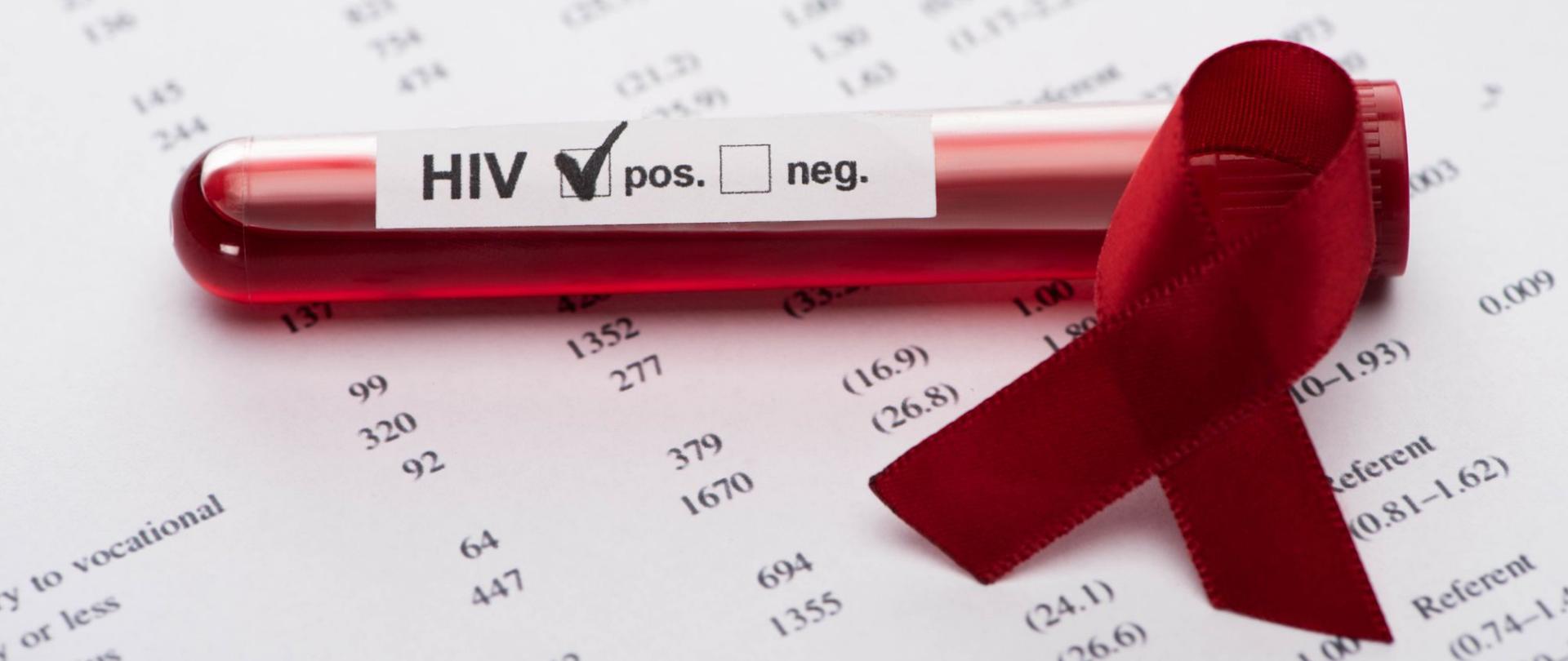 Na zdjęciu jest pozytywny test na HIV obok widnieje czerwona wstążka. W tle są szczegółowe wyniki badań.
