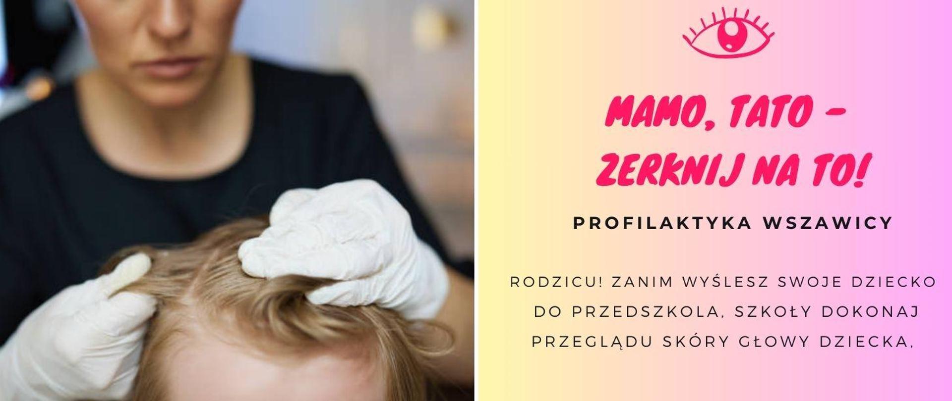 Mamo,_tato_-_zerknij_na_to! Profilaktyka wszawicy. Rodzicu! zanim wyślesz swoje dziecko do przedszkola. szkoły dokonaj przeglądu skóry głowy dziecka