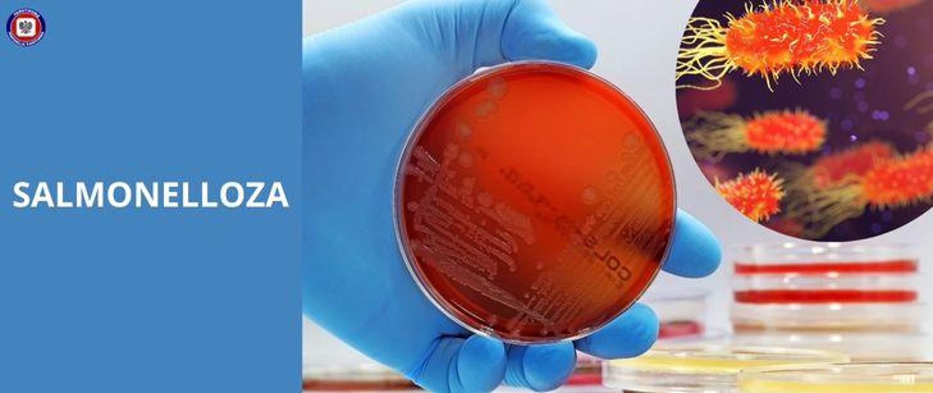 Po prawej w otoczeniu szalek Petriego dłoń w niebieskiej lateksowej rękawiczce trzymająca szalkę Petriego z agarem i wzrostem bakterii. W prawym górnym rogu graficznie przedstawione bakterie Salmonella. Po lewej na niebieskim tle jasny napis "Salmonelloza", w lewym górnym rogu logo Państwowej Inspekcji Sanitarnej.