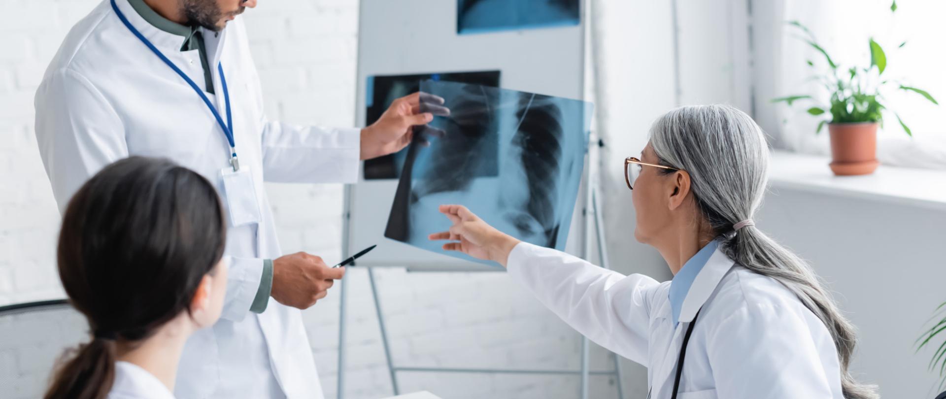 Na zdjęciu są trzy osoby - to lekarze. Patrzą i wskazują na tablicę, na której znajduje się zdjęcie rentgenowskie płuc.