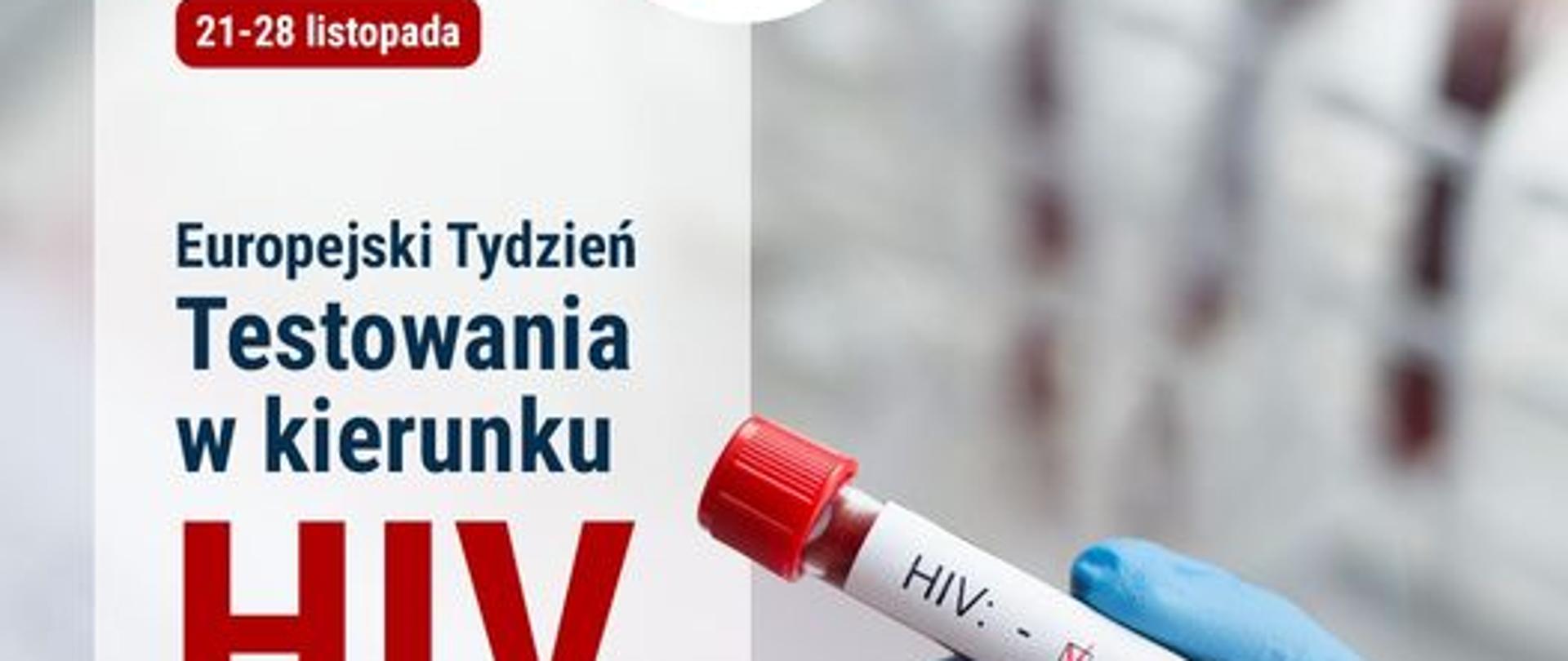 21-28 listopada Europejski Tydzień Testowania w kierunku HIV