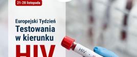 21-28 listopada Europejski Tydzień Testowania w kierunku HIV - format panorama