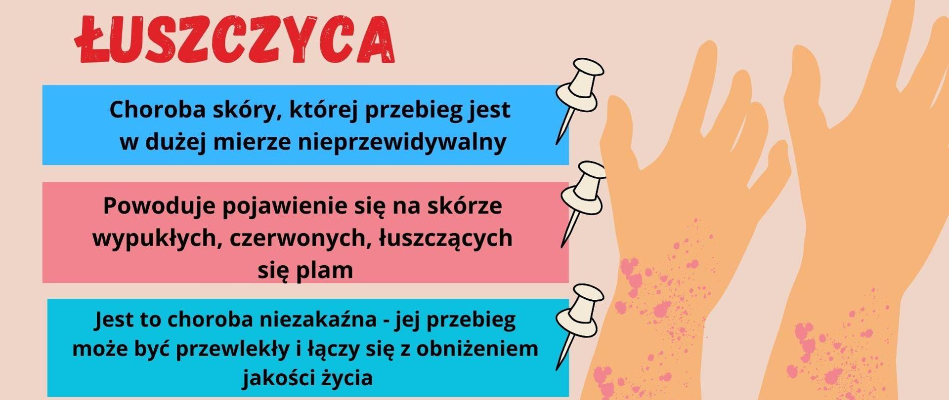 Łuszczyca