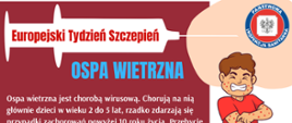 ospa wietrzna