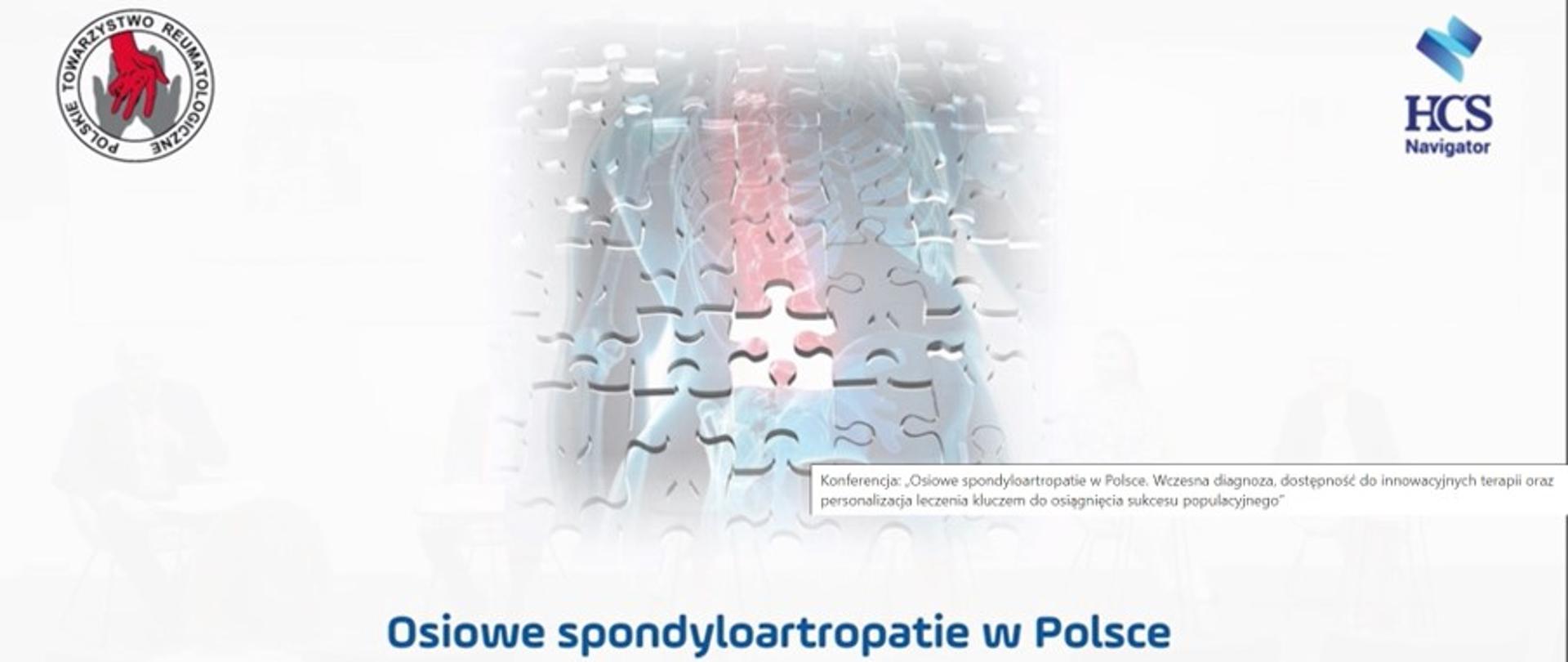 Osiowe spondyloartropatie