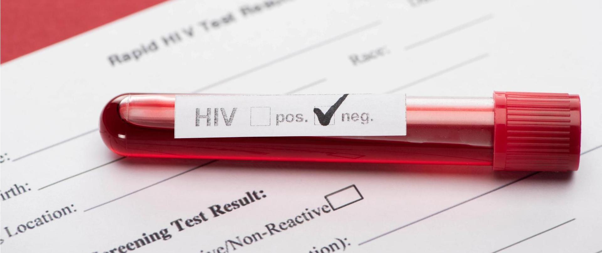 Na zdjęciu jest próbówka z negatywnym wynikiem testu przeciwko HIV.