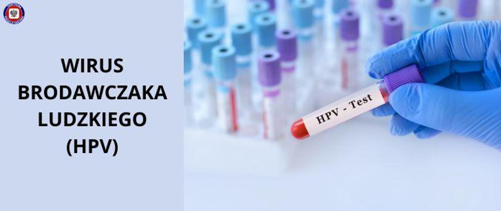Po prawej na tle jasnego blatu z fiolkami próbek laboratoryjnych stojących w jasnych statywach, dłoń w niebieskiej lateksowej rękawiczce trzymająca fiolkę zawierającą próbkę krwi, opisaną ciemnym napisem na białym tle "HPV - Test". Po lewej na błękitnym tle ciemny napis "Wirus brodawczaka ludzkiego (HPV)" W lewym górnym rogu logo Państwowej Inspekcji Sanitarnej. 