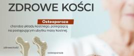 20 października to Światowy Dzień Osteoporozy - format panorama